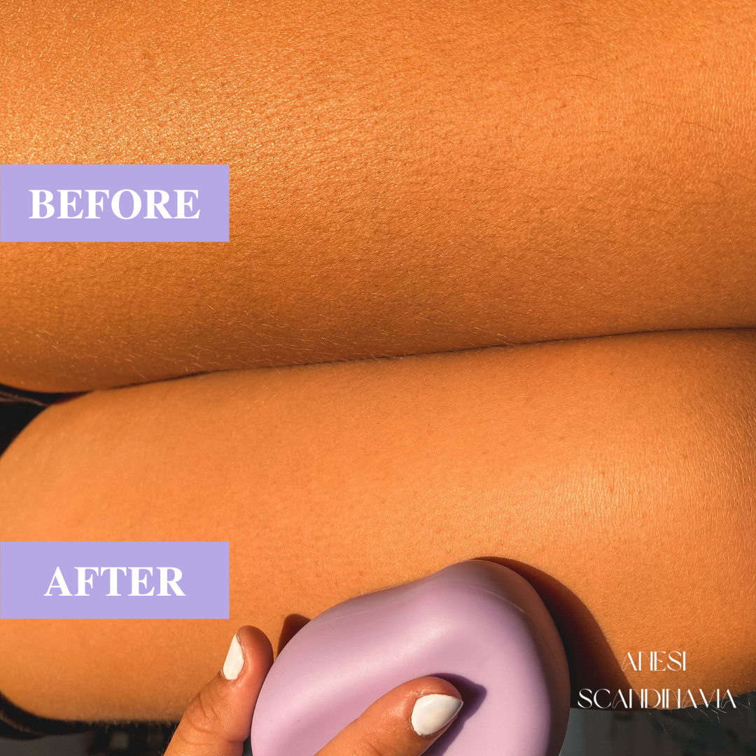 HÈSTIA™ Smärtfri Hårborttagare