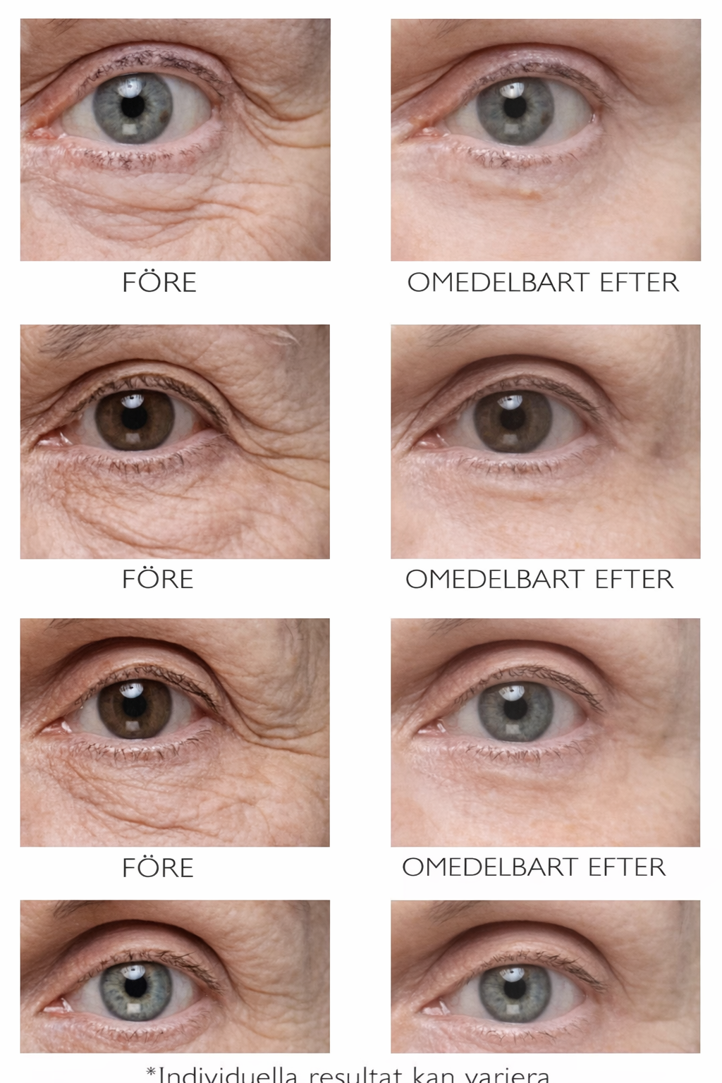 Peter Thomas Roth Instant FIRMx® Eye™ — Omedelbar Uppstramning & Synlig Slätare Blick